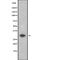 V-Set Domain Containing T Cell Activation Inhibitor 1 antibody, abx219340, Abbexa, Western Blot image 