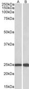 RAN, Member RAS Oncogene Family antibody, NBP1-68870, Novus Biologicals, Western Blot image 