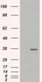 Growth Differentiation Factor 15 antibody, EB06909, Everest Biotech, Western Blot image 