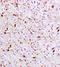 Signal Transducer And Activator Of Transcription 6 antibody, orb11430, Biorbyt, Immunohistochemistry paraffin image 