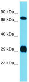 Dorsal Root Ganglia Homeobox antibody, TA341736, Origene, Western Blot image 