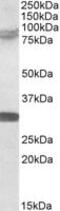 Tripartite Motif Containing 2 antibody, MBS420782, MyBioSource, Western Blot image 