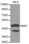 Mitogen-Activated Protein Kinase 9 antibody, TA327027, Origene, Western Blot image 