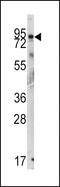 GIT ArfGAP 1 antibody, LS-C100614, Lifespan Biosciences, Western Blot image 