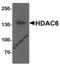Histone Deacetylase 6 antibody, 7901, ProSci, Western Blot image 