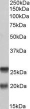 Synaptosome Associated Protein 23 antibody, NBP1-52065, Novus Biologicals, Western Blot image 