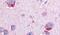 Glycogen Phosphorylase B antibody, PA5-33011, Invitrogen Antibodies, Immunohistochemistry frozen image 