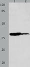 Lysophosphatidic Acid Receptor 4 antibody, TA321700, Origene, Western Blot image 