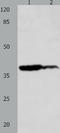 LPA4 antibody, TA321700, Origene, Western Blot image 