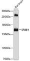 Erb-B2 Receptor Tyrosine Kinase 4 antibody, 13-273, ProSci, Western Blot image 