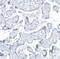 Hydroxysteroid 17-Beta Dehydrogenase 13 antibody, NBP1-90669, Novus Biologicals, Immunohistochemistry paraffin image 