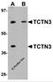 Tectonic Family Member 3 antibody, 5837, ProSci, Western Blot image 
