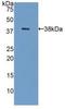 Galectin 8 antibody, LS-C305129, Lifespan Biosciences, Western Blot image 