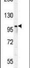 Poly(ADP-Ribose) Polymerase Family Member 8 antibody, PA5-24714, Invitrogen Antibodies, Western Blot image 