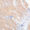 Programmed Cell Death 2 Like antibody, GTX32776, GeneTex, Immunohistochemistry paraffin image 