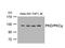 Protein Kinase D1 antibody, A01455-1, Boster Biological Technology, Western Blot image 