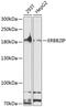 Erbb2 Interacting Protein antibody, GTX64716, GeneTex, Western Blot image 