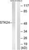 Serine/Threonine Kinase 24 antibody, abx014854, Abbexa, Western Blot image 