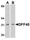 DNA Fragmentation Factor Subunit Beta antibody, 2155, QED Bioscience, Western Blot image 