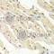 Proteasome Activator Subunit 1 antibody, A5358, ABclonal Technology, Immunohistochemistry paraffin image 