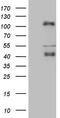 C-Terminal Binding Protein 2 antibody, M02567, Boster Biological Technology, Western Blot image 