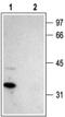 Calcium Voltage-Gated Channel Auxiliary Subunit Gamma 2 antibody, PA5-77304, Invitrogen Antibodies, Western Blot image 