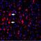 Potassium Voltage-Gated Channel Subfamily A Member 4 antibody, PA5-77659, Invitrogen Antibodies, Immunohistochemistry paraffin image 