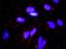 Fibroblast growth factor 10 antibody, H00002255-M05, Novus Biologicals, Proximity Ligation Assay image 