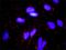 Fibroblast Growth Factor 10 antibody, H00002255-M05, Novus Biologicals, Proximity Ligation Assay image 