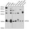 Eukaryotic Translation Initiation Factor 5A2 antibody, GTX64649, GeneTex, Western Blot image 