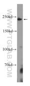 SMMHC antibody, 60222-2-Ig, Proteintech Group, Western Blot image 