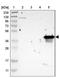 Transmembrane Protein 25 antibody, NBP1-82237, Novus Biologicals, Western Blot image 