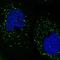 Speckle Type BTB/POZ Protein Like antibody, PA5-57014, Invitrogen Antibodies, Immunofluorescence image 