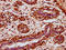 POU Class 3 Homeobox 4 antibody, LS-C681097, Lifespan Biosciences, Immunohistochemistry paraffin image 