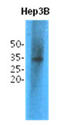 Thiopurine S-Methyltransferase antibody, LS-C175796, Lifespan Biosciences, Western Blot image 