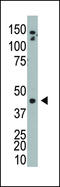 Adenosine Kinase antibody, LS-C98051, Lifespan Biosciences, Western Blot image 