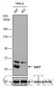 X-Linked Inhibitor Of Apoptosis antibody, GTX100496, GeneTex, Western Blot image 