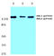 ABL Proto-Oncogene 1, Non-Receptor Tyrosine Kinase antibody, AP20818PU-N, Origene, Western Blot image 