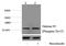 Histone Cluster 1 H1 Family Member A antibody, P09849, Boster Biological Technology, Western Blot image 