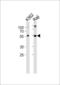 Hematopoietic Cell-Specific Lyn Substrate 1 antibody, LS-C166815, Lifespan Biosciences, Western Blot image 