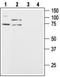 Hypocretin Receptor 2 antibody, TA328919, Origene, Western Blot image 