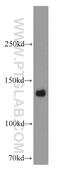 Centromere Protein C antibody, 14250-1-AP, Proteintech Group, Western Blot image 