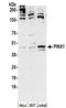 PIN2 (TERF1) Interacting Telomerase Inhibitor 1 antibody, NBP2-32265, Novus Biologicals, Western Blot image 