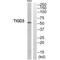Tigger Transposable Element Derived 3 antibody, A19473, Boster Biological Technology, Western Blot image 