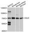 Squalene Epoxidase antibody, A2428, ABclonal Technology, Western Blot image 
