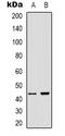 Armadillo Repeat Containing X-Linked 3 antibody, abx133662, Abbexa, Western Blot image 