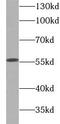 Glucose-6-Phosphate Isomerase antibody, FNab10496, FineTest, Western Blot image 