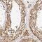 Vezatin, Adherens Junctions Transmembrane Protein antibody, PA5-52115, Invitrogen Antibodies, Immunohistochemistry frozen image 