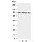 Aryl Hydrocarbon Receptor antibody, R30876, NSJ Bioreagents, Western Blot image 