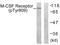 Colony Stimulating Factor 1 Receptor antibody, LS-C199236, Lifespan Biosciences, Western Blot image 